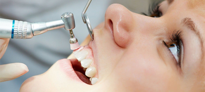 Сепарация зубов