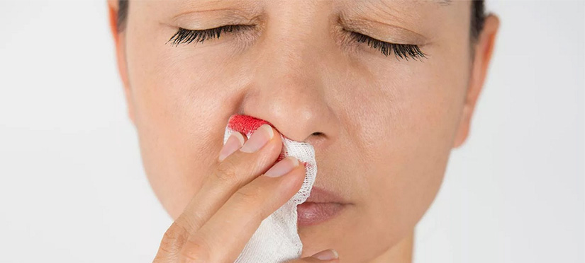 Причины, которые могут вызывать носовые кровотечение
