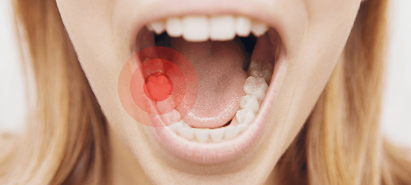 Киста зуба особенности заболевания