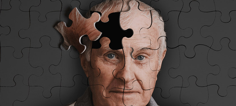 Что такое болезнь Альцгеймера