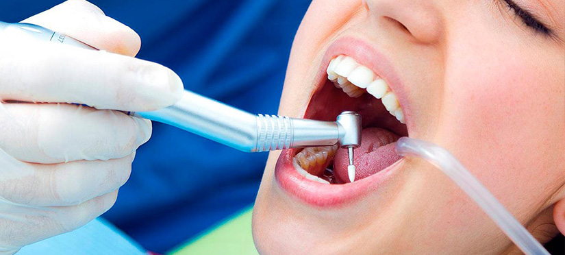 Как пломбируют зубы этапы и необходимые материалы