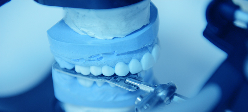 Синус-лифтинг в стоматологии показания, проведение процедуры