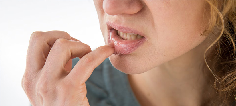 Виды поражений слизистой рта