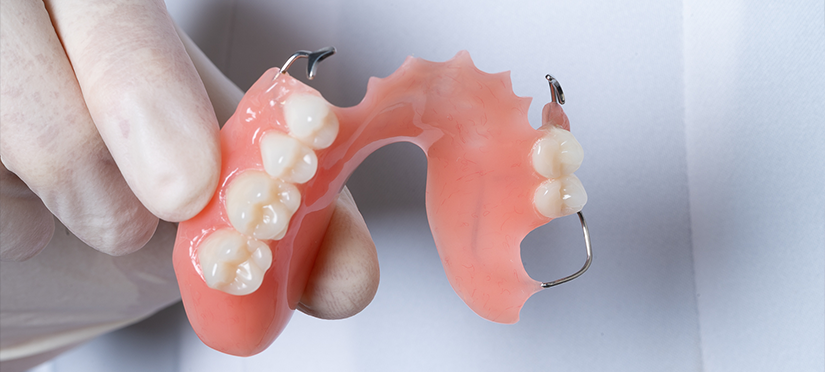 Пластиночное зубное протезирование особенности, преимущества и недостатки